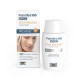 Foto Ultra 100 Isdin Spot Prevent Fusion Fluid SPF 100+